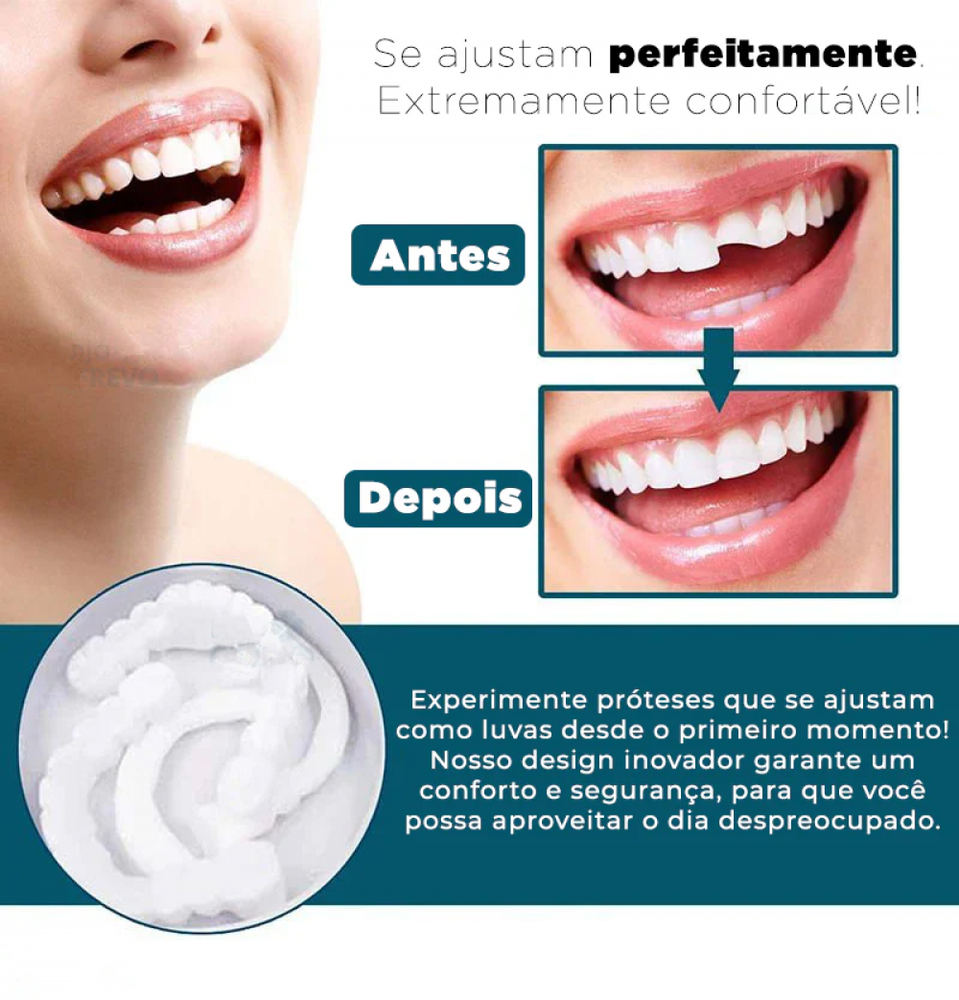 Dentfit - Facetas Dentárias Naturais removíveis ( Superior e Inferior)