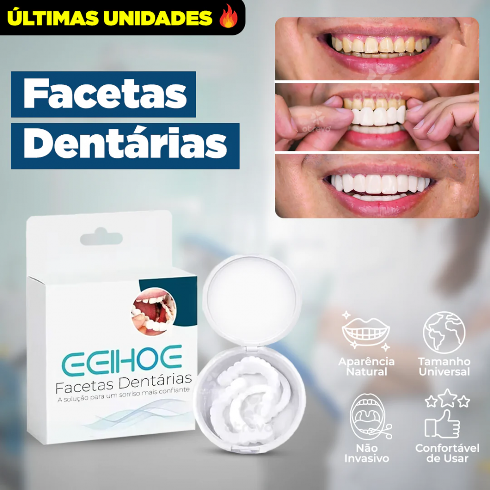 Dentfit - Facetas Dentárias Naturais removíveis ( Superior e Inferior)