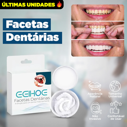 Dentfit - Facetas Dentárias Naturais removíveis ( Superior e Inferior)